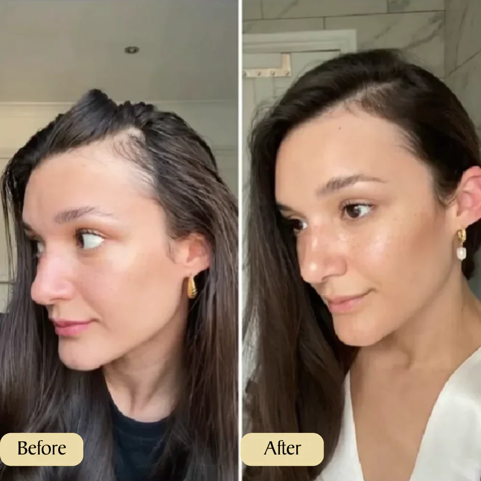 🔥Your Natural Oil Treatment for Hair Growth