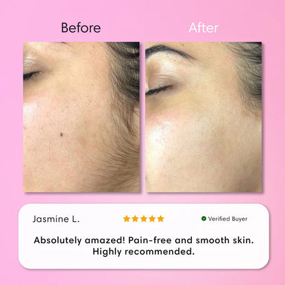 Hair Removal Kit