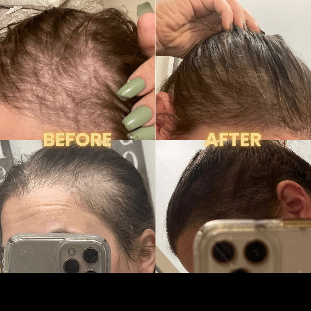 Scalp Stimulator Hair Growth Oil