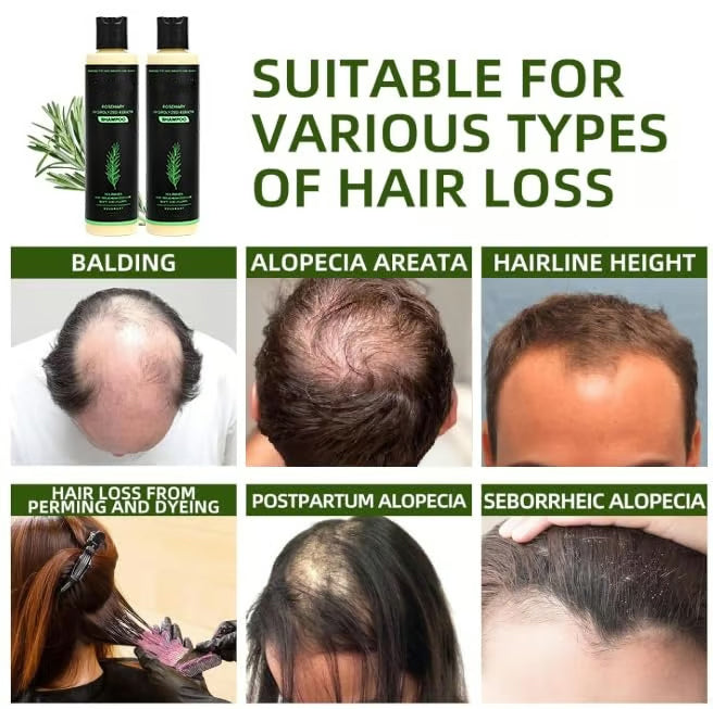 Organic Rosemary Hair Growth Shampoo
