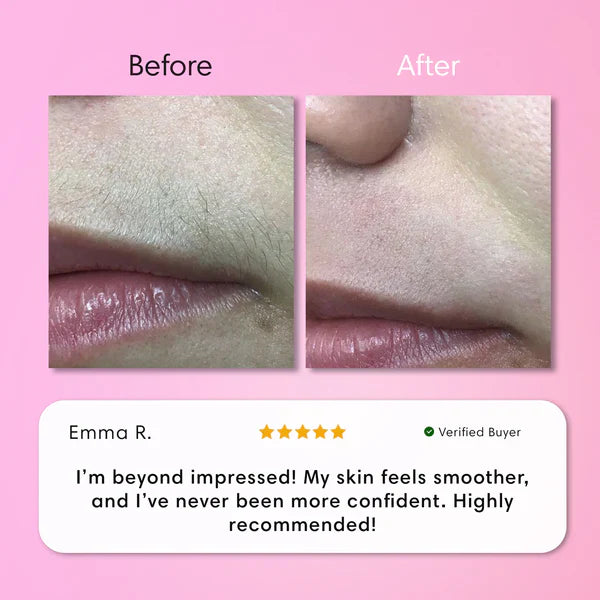 Hair Removal Kit