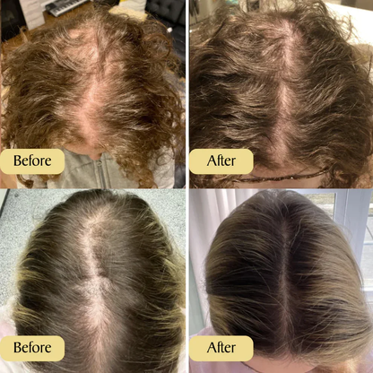 🔥Your Natural Oil Treatment for Hair Growth