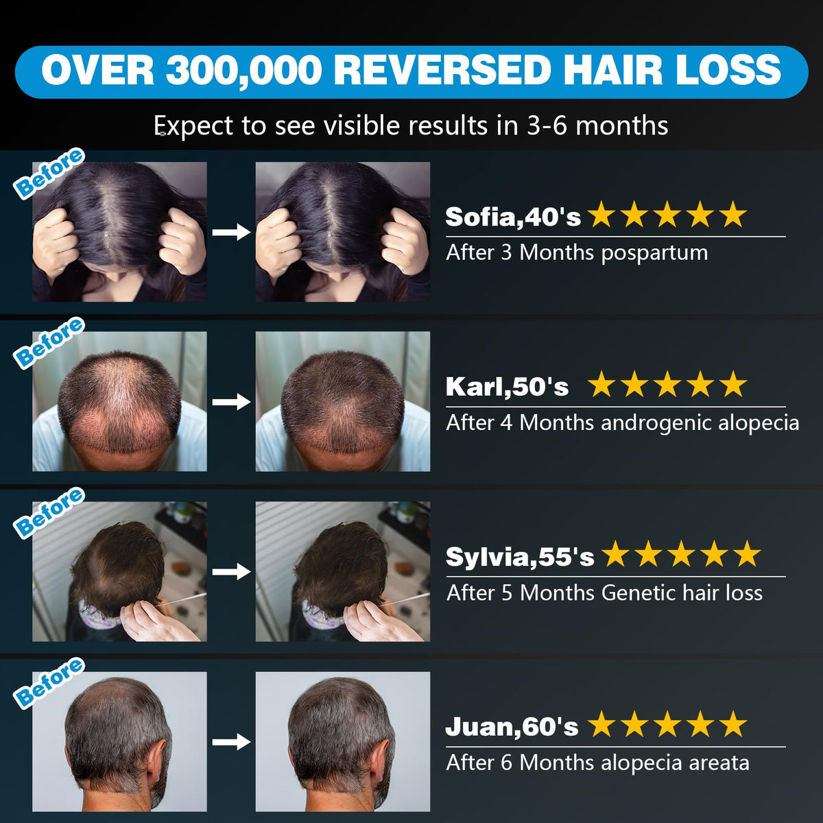 Red Light Therapy Hair Growth Cap