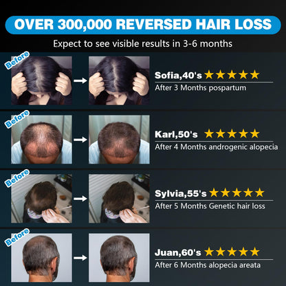 Red Light Therapy Hair Growth Cap