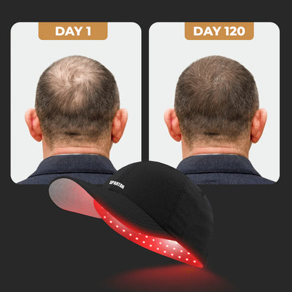 Red Light Therapy Hair Growth Cap