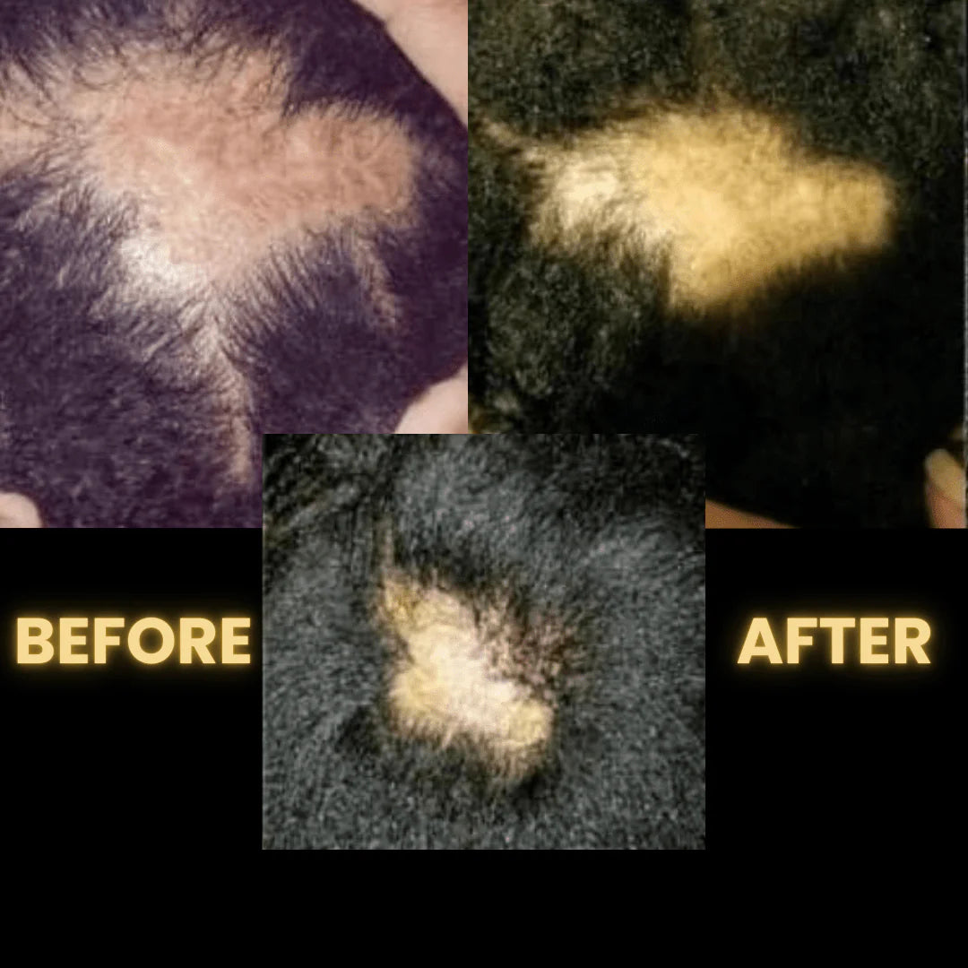 Scalp Stimulator Hair Growth Oil