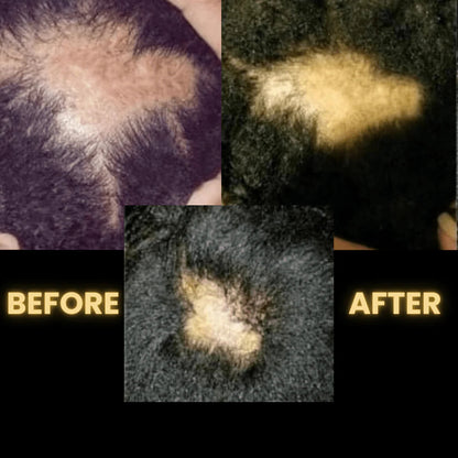 Scalp Stimulator Hair Growth Oil