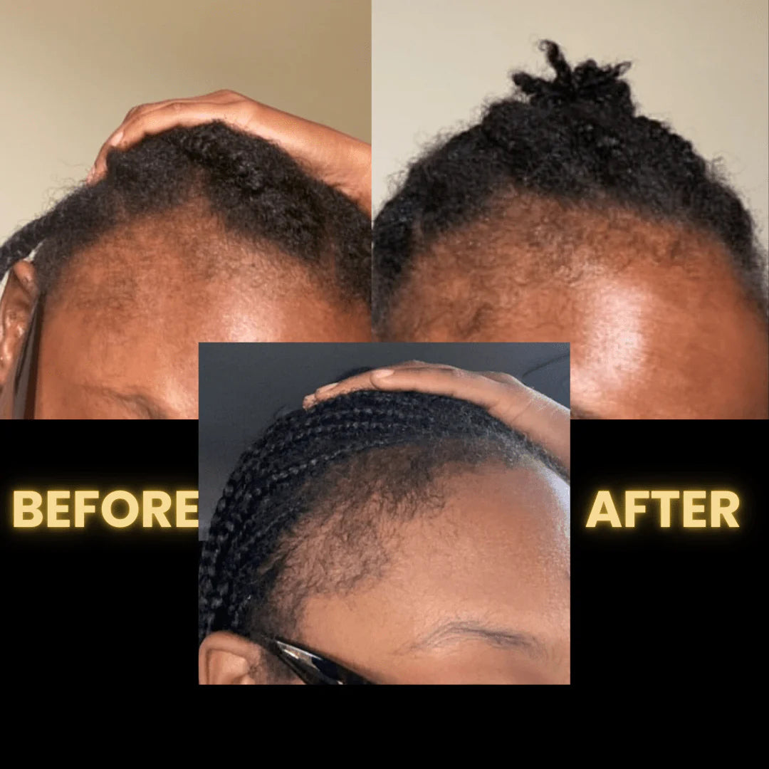 Scalp Stimulator Hair Growth Oil