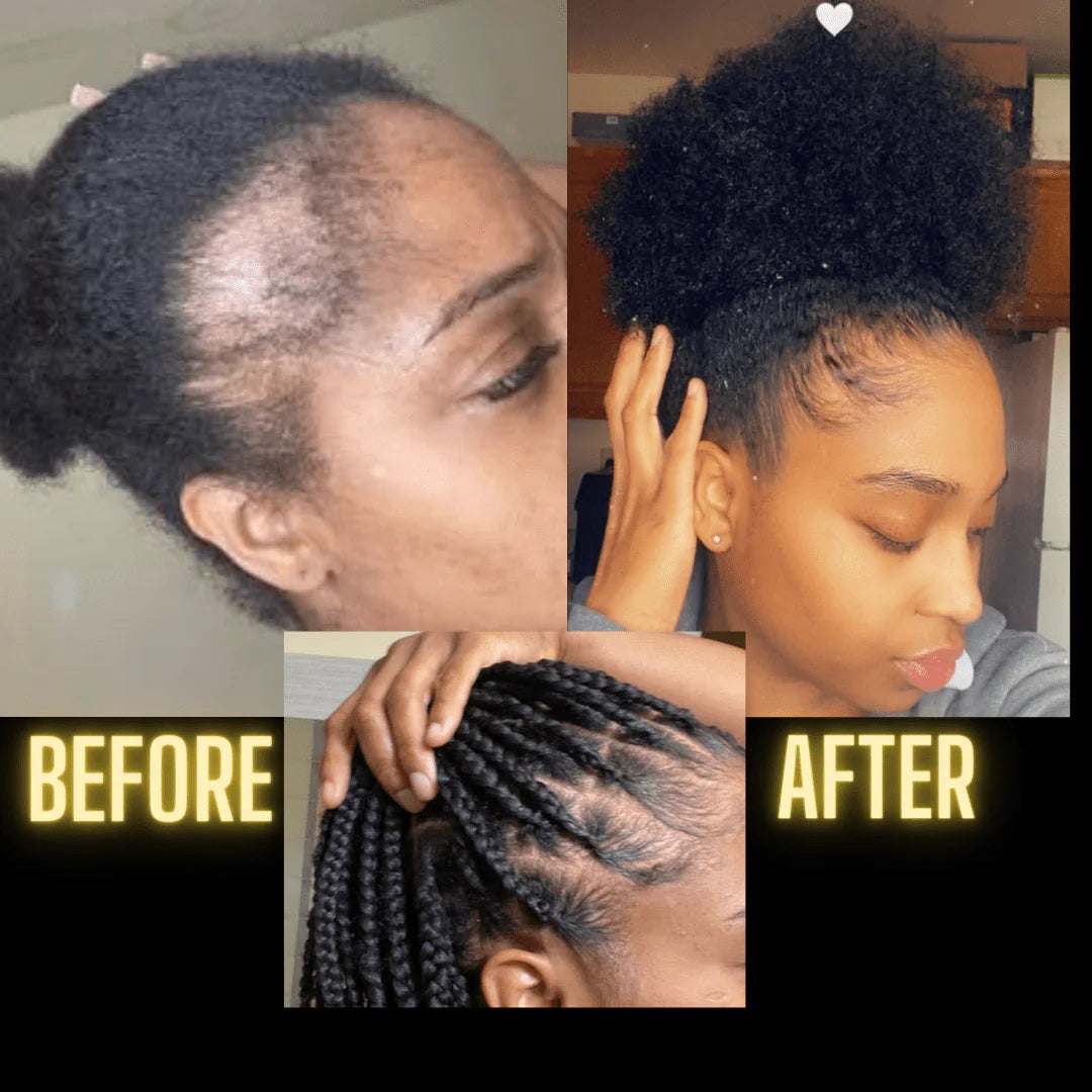 Scalp Stimulator Hair Growth Oil