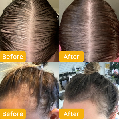 🔥Your Natural Oil Treatment for Hair Growth