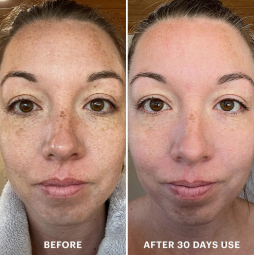 💧Last day Promotion 🔥-✨ EGF Peptide Firming Toner for Smoother, Firmer & Radiant-Looking Skin 💧