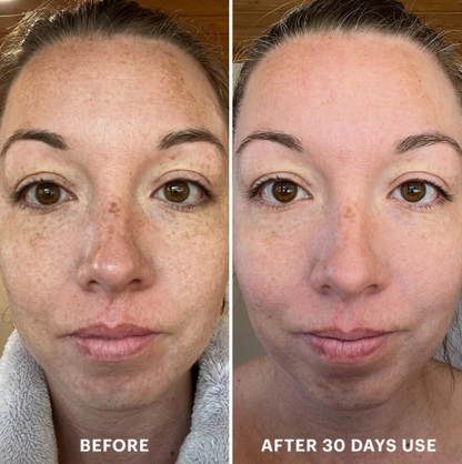 💧Last day Promotion 🔥-✨ EGF Peptide Firming Toner for Smoother, Firmer & Radiant-Looking Skin 💧