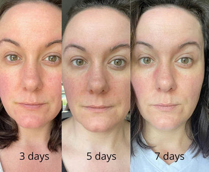 💧Last day Promotion 🔥-✨ EGF Peptide Firming Toner for Smoother, Firmer & Radiant-Looking Skin 💧