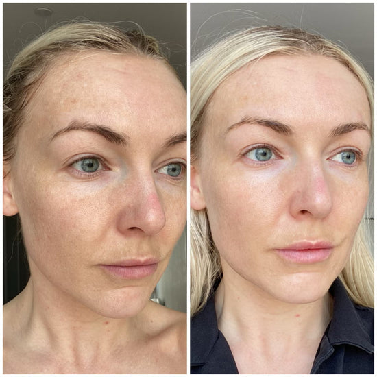 💧Last day Promotion 🔥-✨ EGF Peptide Firming Toner for Smoother, Firmer & Radiant-Looking Skin 💧