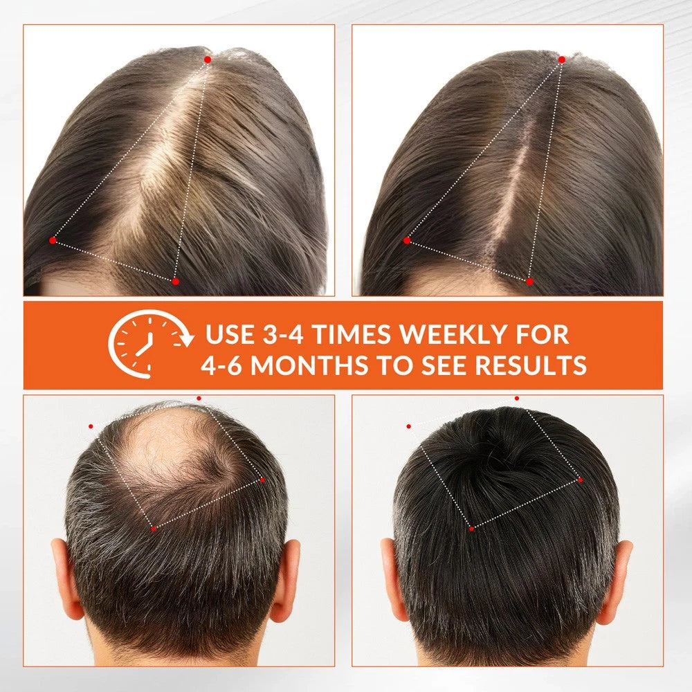 Red Light Therapy Hair Growth Cap