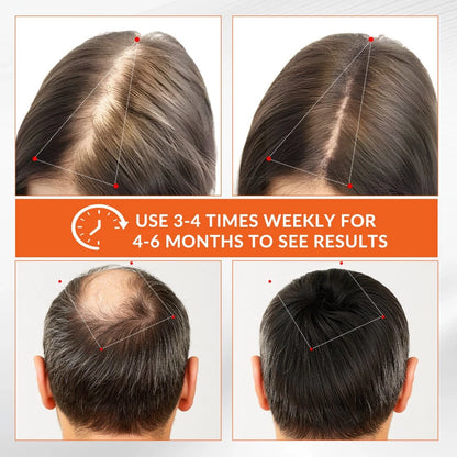Red Light Therapy Hair Growth Cap